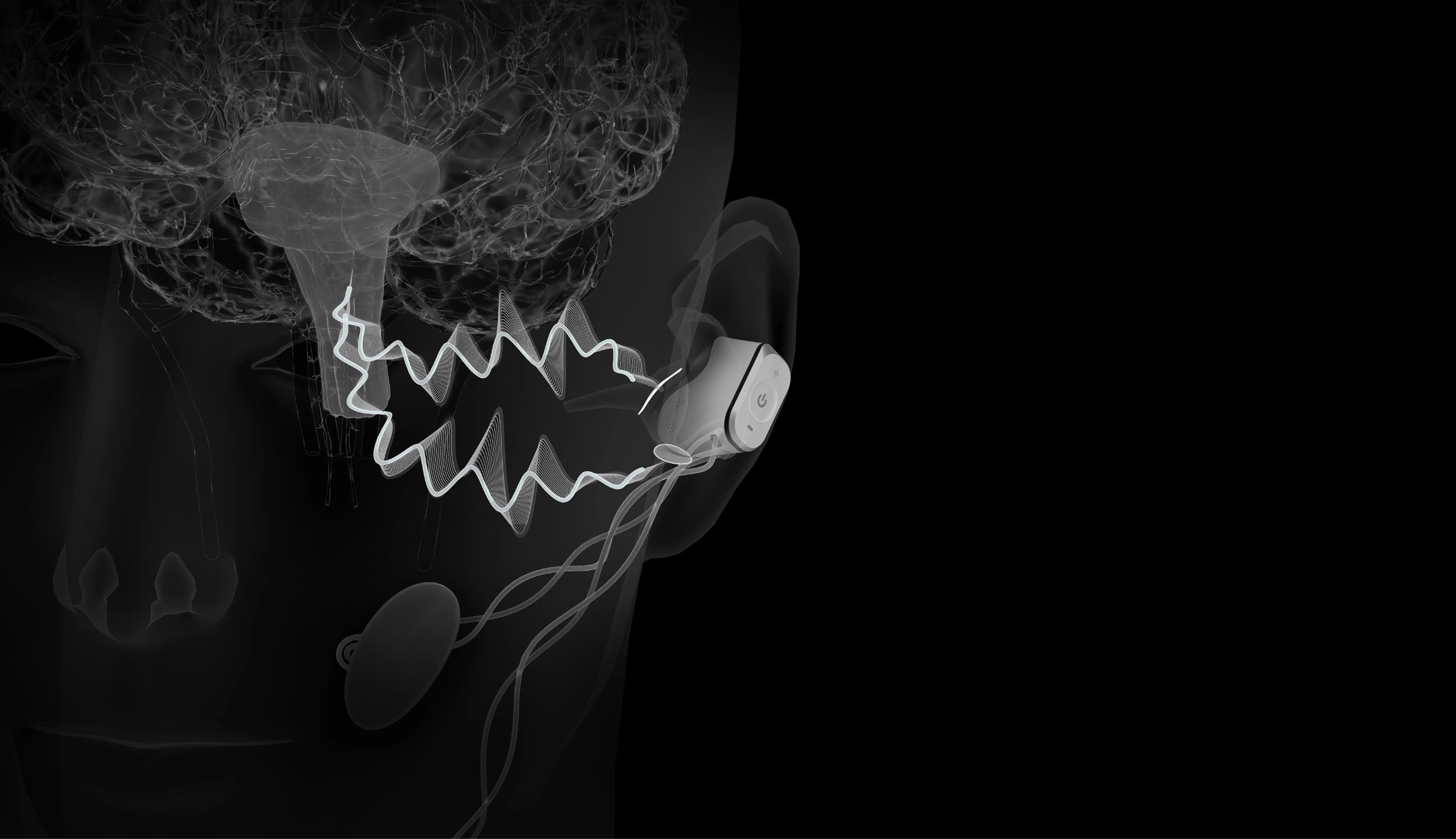 Vagakey project image 5
